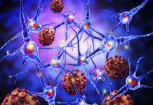 Testosterone-induced Molecule Could Explain Why Men are Better Guarded against MS