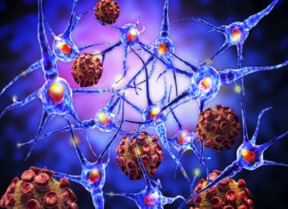 Testosterone-induced Molecule Could Explain Why Men are Better Guarded against MS