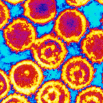 Scientists Describe Kaposi’s Sarcoma Virus Structure, Herald Potential Roadmap for Drug Development Scientists Describe Kaposi's Sarcoma Virus Structure