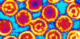 Scientists Describe Kaposi's Sarcoma Virus Structure