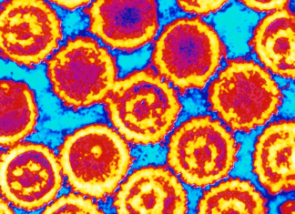 Scientists Describe Kaposi's Sarcoma Virus Structure