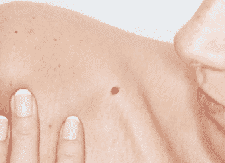 Soil Bacterium Could Be Potentially Effective Against Melanoma Soil Bacterium Could Be Potentially Effective Against Melanoma