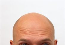 Cure for Baldness? Mouse Stem Cells Aid Researchers in Production of Hairy Skin Indiana University School of Medicine researchers have cultured the first lab-grown skin tissue complete with hair follicles