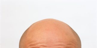 Indiana University School of Medicine researchers have cultured the first lab-grown skin tissue complete with hair follicles