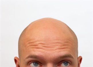 Cure for Baldness? Mouse Stem Cells Aid Researchers in Production of Hairy Skin Indiana University School of Medicine researchers have cultured the first lab-grown skin tissue complete with hair follicles