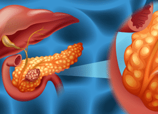 Researchers Reform Flu Virus to Inhibit Pancreatic Cancer