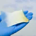 Biodegradable Bandages Expedite Normal Regeneration of Burnt Tissue