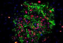 Induced Pluripotent Stem Cells Hold Potential as Cancer Vaccines: Stanford Study