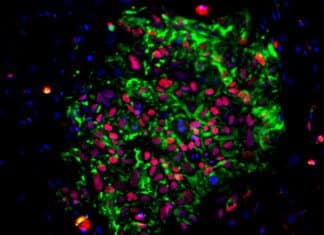 Induced Pluripotent Stem Cells Hold Potential as Cancer Vaccines: Stanford Study