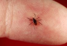 New Serochip Test for Diagnosis of Tick-Borne Diseases New Serochip Test for Diagnosis of Tick-Borne Diseases
