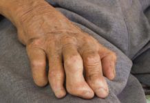 Genome-Wide Association Studies Reveal Rising Leprosy Resistance Trends Genome-Wide Association Studies Reveal Rising Leprosy Resistance