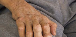 Genome-Wide Association Studies Reveal Rising Leprosy Resistance