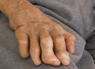 Genome-Wide Association Studies Reveal Rising Leprosy Resistance Trends Genome-Wide Association Studies Reveal Rising Leprosy Resistance