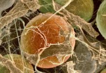 A Native Brown Fat Protein Key to How the Fat Cells Function A Native Brown Fat Protein Key to How the Fat Cells Function