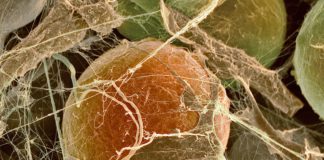 A Native Brown Fat Protein Key to How the Fat Cells Function
