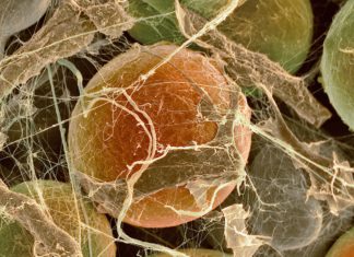 A Native Brown Fat Protein Key to How the Fat Cells Function A Native Brown Fat Protein Key to How the Fat Cells Function