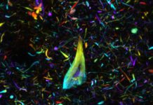 OPTIclear: A Stunning 3D Tech that Allows for High-Resolution, Archival Imaging of Brain