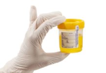 Urine Test to Determine Biological Age