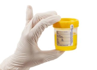 Urine Test to Determine Biological Age