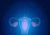 Australia Purging Cervical Cancer, to Eradicate Disease Soon Australia Purging Cervical Cancer, to Eradicate Disease Soon