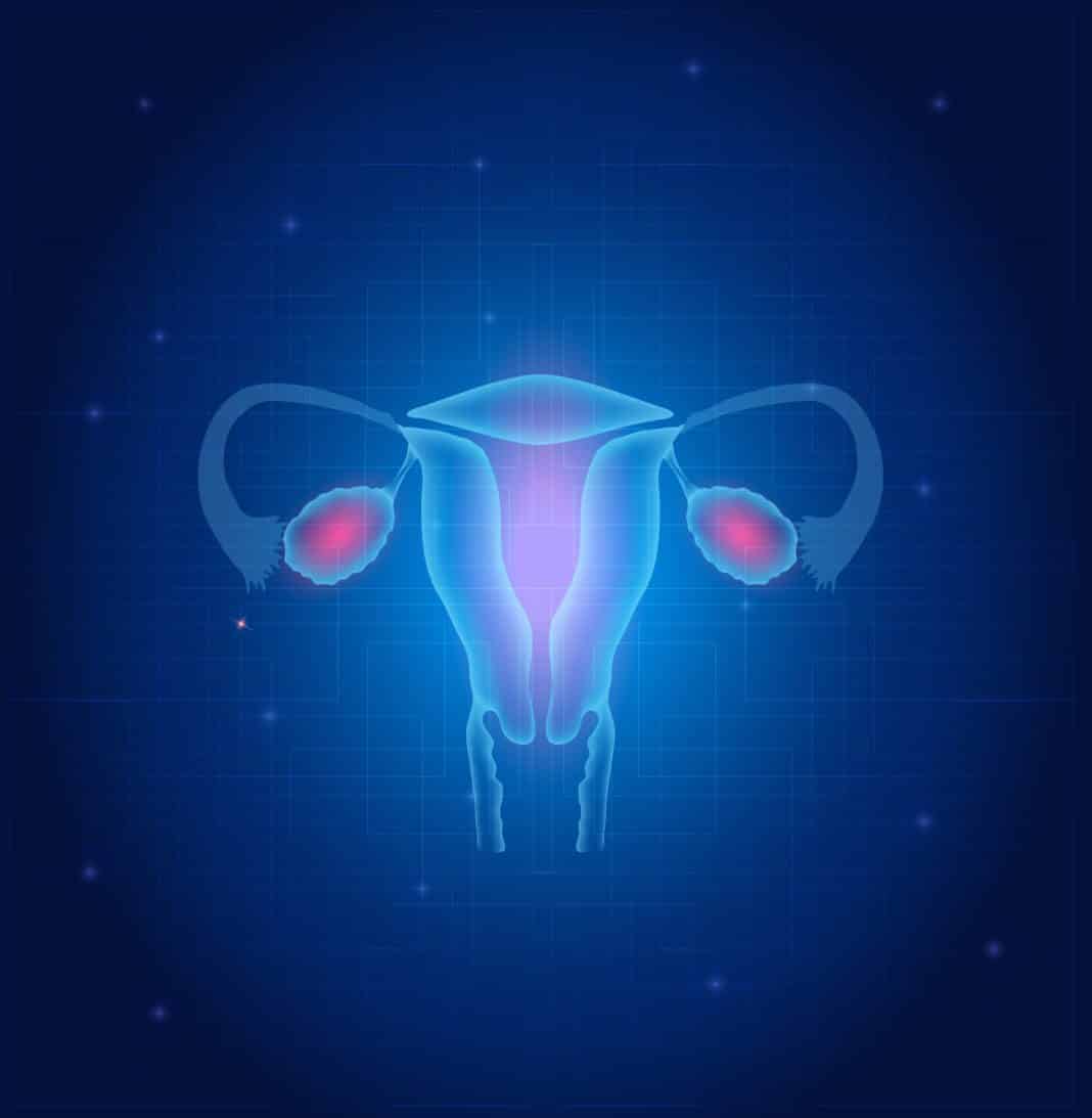 Australia Purging Cervical Cancer, to Eradicate Disease Soon