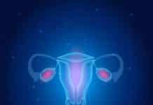 Australia Purging Cervical Cancer, to Eradicate Disease Soon Australia Purging Cervical Cancer, to Eradicate Disease Soon