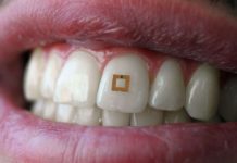 Hey! Something’s Stuck to your Tooth | Wait, that’s a Diet Sensor