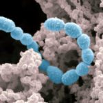 Graphene Spikes that Devour Bacteria to Keep Out Infections Graphene Spikes that Devour Bacteria to Keep Out Infections