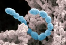 Graphene Spikes that Devour Bacteria to Keep Out Infections Graphene Spikes that Devour Bacteria to Keep Out Infections