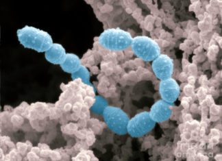 Graphene Spikes that Devour Bacteria to Keep Out Infections Graphene Spikes that Devour Bacteria to Keep Out Infections