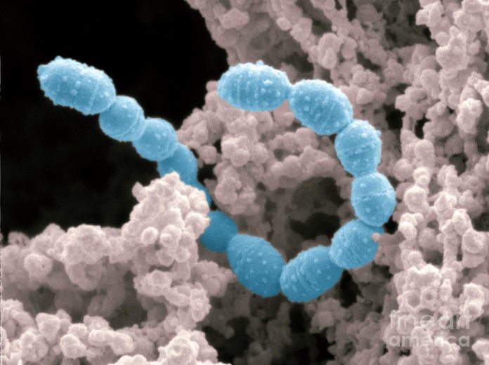 Graphene Spikes that Devour Bacteria to Keep Out Infections