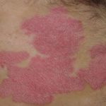 Macrophage-Derived Compound to Treat Autoimmune Disorders