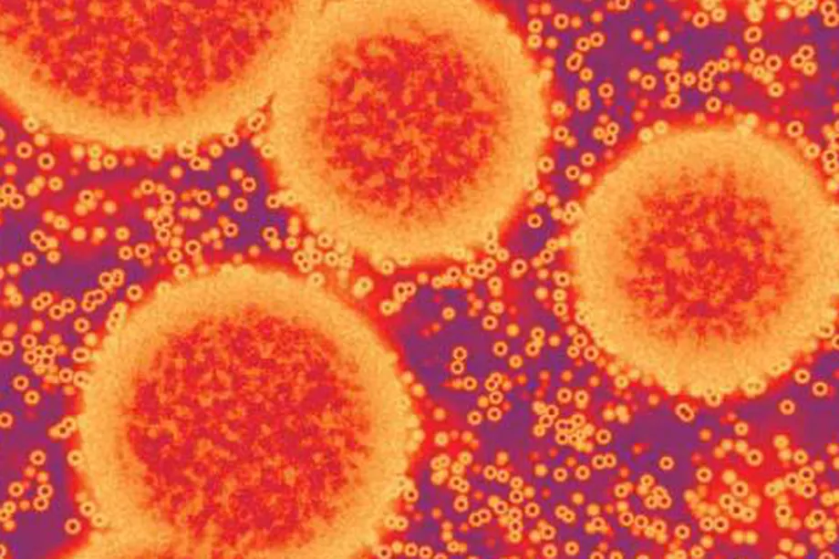 Study Explores How Norovirus Latches onto Host Cells