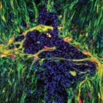 Doctors Looking to Customise Brain-Immune System Interactions