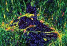 Doctors Looking to Customise Brain-Immune System Interactions Doctors Looking to Customise Brain-Immune System Interactions