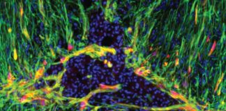 Doctors Looking to Customise Brain-Immune System Interactions