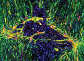 Doctors Looking to Customise Brain-Immune System Interactions Doctors Looking to Customise Brain-Immune System Interactions