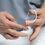 Non-Invasive Portable Device Allows WBC Levels Estimation in Chemotherapy Patients