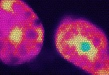 Proteins Responding to Nicotine Shed Light on Energy Burning of Fat Cells