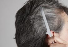 Graying of Hair Linked to Dysregulated Immune System Graying of Hair Linked to Dysregulated Immune System