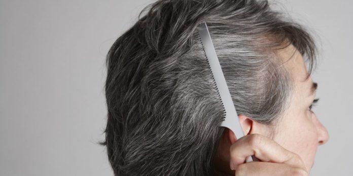 Graying of Hair Linked to Dysregulated Immune System