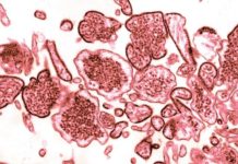 Three Confirmed Nipah Virus Deaths, Centre on High Alert Three Confirmed Nipah Virus Deaths, Centre on High Alert