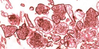 Three Confirmed Nipah Virus Deaths, Centre on High Alert