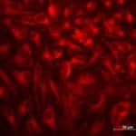 Enhanced Autophagy for Promising Therapies for Age-Related Diseases