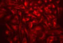 Scientists Enhance Autophagy, Could Lead to Promising Future Therapies for Age-Related Diseases Enhanced Autophagy for Promising Therapies for Age-Related Diseases