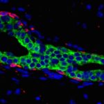 Scientists Discover Signalling Exchange that Could Possibly be Driving Breast Cancer Scientists Discover Signalling Exchange that Could Possibly be Driving Breast Cancer