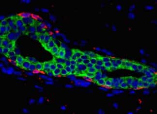 Scientists Discover Signalling Exchange that Could Possibly be Driving Breast Cancer Scientists Discover Signalling Exchange that Could Possibly be Driving Breast Cancer