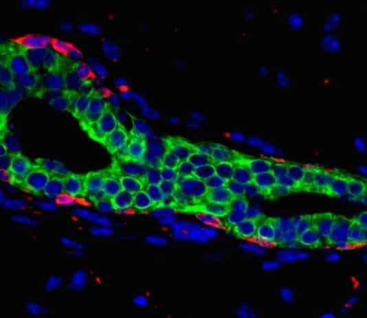 Scientists Discover Signalling Exchange that Could Possibly be Driving Breast Cancer