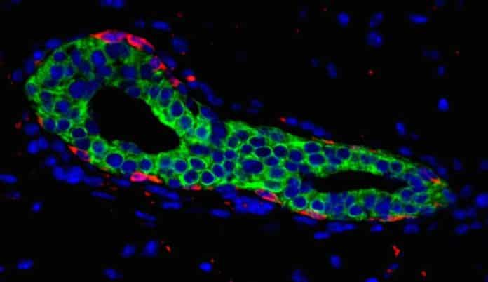 Scientists Discover Signalling Exchange that Could Possibly be Driving Breast Cancer