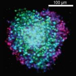 3D Screening of Anti-Cancer Drugs Employing Cell Aggregates Shows Promise